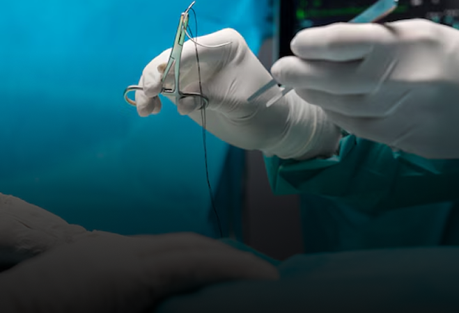 Spontaneous superior mesenteric vein tear.